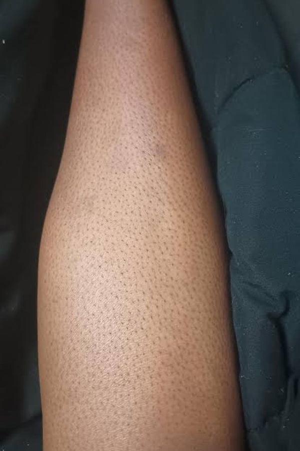 Day 1