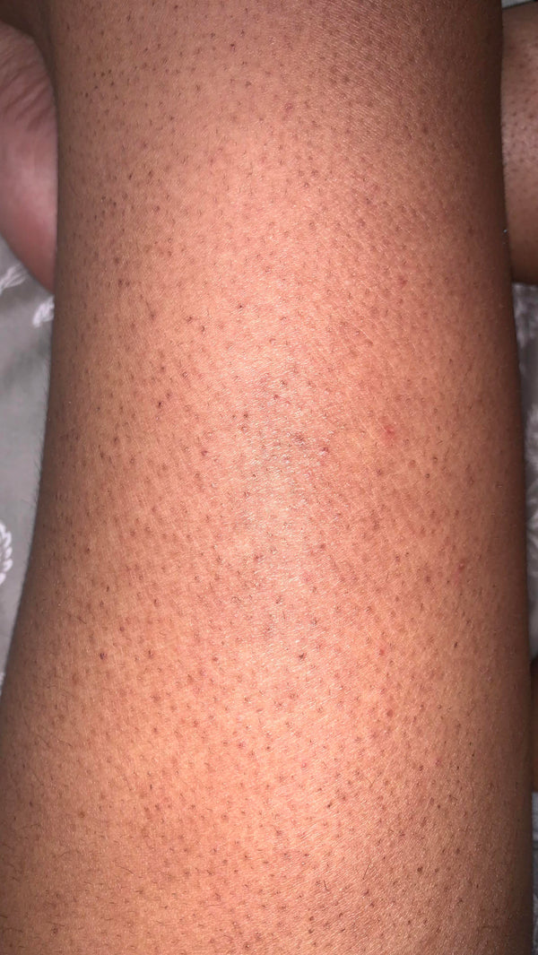 Day 1